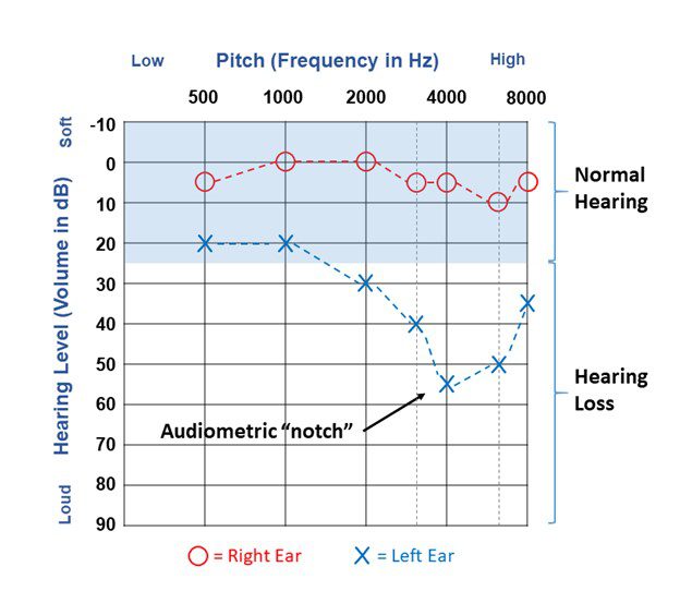 hearing level and pitch chart